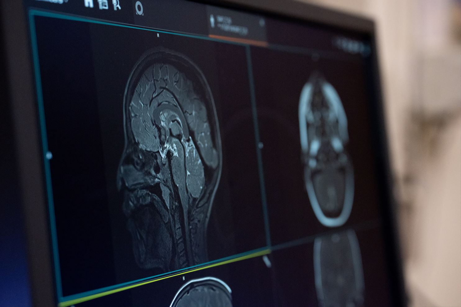 MRI scanner and participant preparation